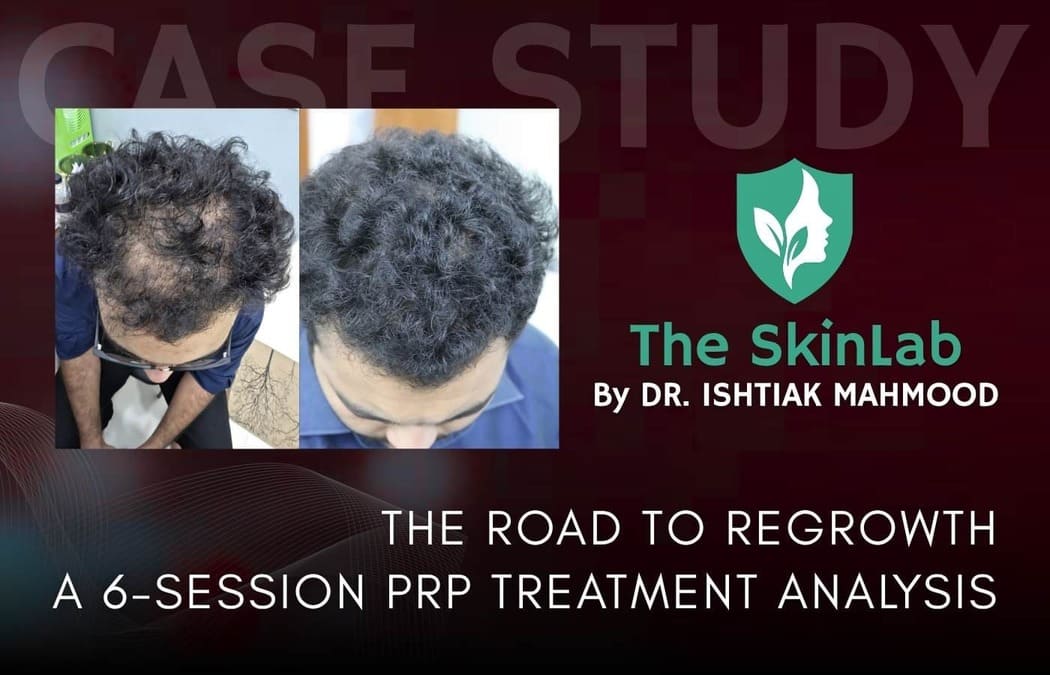 The Roadmap to Regrowth: A 6-Session Clinical Diary