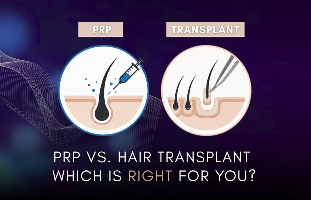 PRP vs. Hair Transplant: The Honest Clinical Comparison