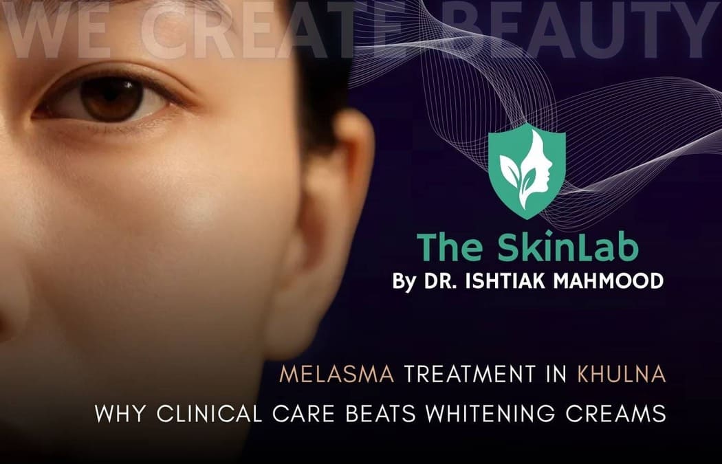 Melasma Treatment in Khulna: Why Clinical Care Beats Whitening Creams